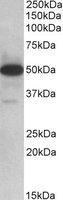 TXNDC5 / ERP46 Antibody - TXNDC5 antibody (0.1 ug/ml) staining of Human Lymph Nodes lysate (35 ug protein/ml in RIPA buffer). Primary incubation was 1 hour. Detected by chemiluminescence.