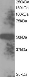TXNDC5 / ERP46 Antibody - Antibody staining (0.1 ug/ml) of human placenta lysate (RIPA buffer, 35 ug total protein per lane). Primary incubated for 1 hour. Detected by western blot using chemiluminescence.