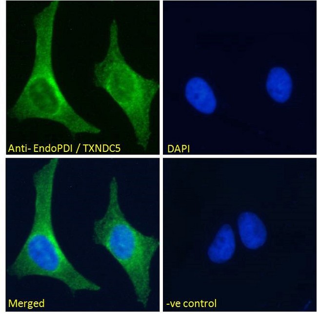 TXNDC5 / ERP46 Antibody - Goat Anti-EndoPDI / TXNDC5 Antibody Immunofluorescence analysis of paraformaldehyde fixed U2OS cells, permeabilized with 0.15% Triton. Primary incubation 1hr (10ug/ml) followed by Alexa Fluor 488 secondary antibody (2ug/ml), showing endoplasmic reticulum staining. The nuclear stain is DAPI (blue). Negative control: Unimmunized goat IgG (10ug/ml) followed by Alexa Fluor 488 secondary antibody (2ug/ml).