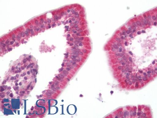 TXNIP Antibody - Human Small Intestine: Formalin-Fixed, Paraffin-Embedded (FFPE)