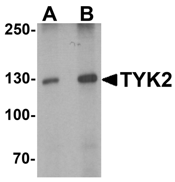 TYK2 Antibody - Western blot analysis of TYK2 in human small intestine tissue lysate with TYK2 antibody at (A) 1 and (B) 2 ug/ml