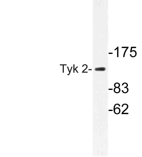 TYK2 Antibody - Western blot of Tyk 2 (V1048) pAb in extracts from 293cells.