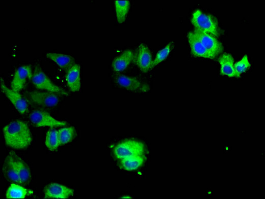 TYRO3 Antibody - Immunofluorescent analysis of HepG2 cells using TYRO3 Antibody at a dilution of 1:100 and Alexa Fluor 488-congugated AffiniPure Goat Anti-Rabbit IgG(H+L)