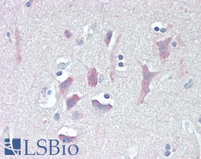 TYRO3 Antibody - Human Brain, Cortex: Formalin-Fixed, Paraffin-Embedded (FFPE), at a concentration of 10 ug/ml. 