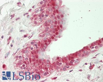 UBA1 / UBE1 Antibody - Human Breast: Formalin-Fixed, Paraffin-Embedded (FFPE)