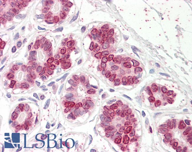UBASH3A / CLIP4 Antibody - Anti-UBASH3A antibody IHC of human breast. Immunohistochemistry of formalin-fixed, paraffin-embedded tissue after heat-induced antigen retrieval. Antibody dilution 3.75 ug/ml.