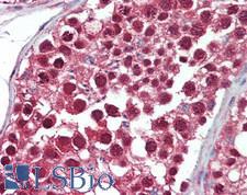 UBE1L2 / UBE1L2 Antibody - Human Testis: Formalin-Fixed, Paraffin-Embedded (FFPE)