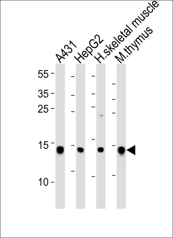 UBE2D1 / UBCH5 Antibody - Western blot of lysates from A431, HepG2 cell line, human skeletal muscle and mouse thymus tissue lysate(from left to right), using hUBE2D1-I126. Antibody was diluted at 1:1000 at each lane. A goat anti-rabbit IgG H&L (HRP) at 1:10000 dilution was used as the secondary antibody. Lysates at 35ug per lane.