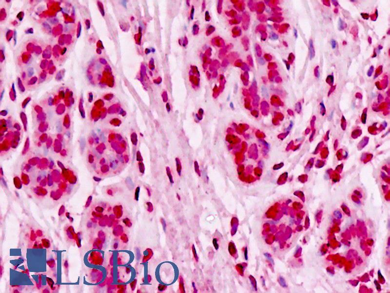 UBE2D1 / UBCH5 Antibody - Anti-UBE2D1 / UBCH5 antibody IHC staining of human breast, epithelium. Immunohistochemistry of formalin-fixed, paraffin-embedded tissue after heat-induced antigen retrieval.