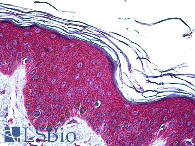 UBE2D2 / UBCH5B Antibody - Anti-UBE2D2 antibody IHC of human skin. Immunohistochemistry of formalin-fixed, paraffin-embedded tissue after heat-induced antigen retrieval. Antibody concentration 5 ug/ml.