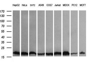 UBE2G2 Antibody - Western blot of extracts (35 ug) from 9 different cell lines by using anti-UBE2G2 monoclonal antibody (HepG2: human; HeLa: human; SVT2: mouse; A549: human; COS7: monkey; Jurkat: human; MDCK: canine; PC12: rat; MCF7: human).