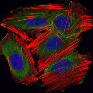 UBE2I / UBC9 Antibody - Immunofluorescence of HepG2 cells using UBE2I mouse monoclonal antibody (green). Blue: DRAQ5 fluorescent DNA dye. Red: Actin filaments have been labeled with Alexa Fluor-555 phalloidin.