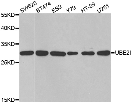 UBE2I / UBC9 Antibody - Western blot analysis of extracts of various cell lines, using UBE2I antibody.