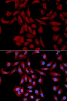 UBE2I / UBC9 Antibody - Immunofluorescence analysis of U2OS cell using UBE2I antibody. Blue: DAPI for nuclear staining.