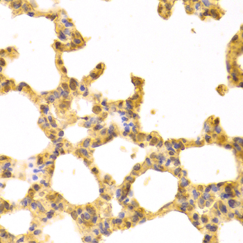 UBE2I / UBC9 Antibody - Immunohistochemistry of paraffin-embedded rat lung tissue.