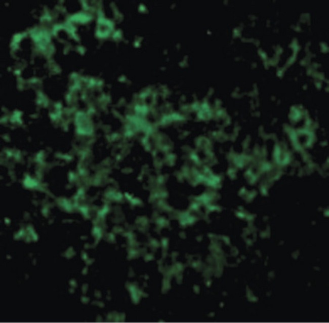 UBE2N / UBC13 Antibody - Immunofluorescence of UBC13 in Mouse Thymus cells with UBC13 antibody at 10 ug/ml.