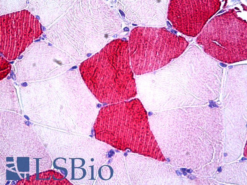 UBE2O Antibody - Anti-UBE2O antibody IHC of human skeletal muscle. Immunohistochemistry of formalin-fixed, paraffin-embedded tissue after heat-induced antigen retrieval. Antibody concentration 3.75 ug/ml.