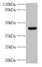 UBE2Q2 Antibody - Western blot All lanes: UBE2Q2 antibody at 2µg/ml + A431 whole cell lysate Secondary Goat polyclonal to rabbit IgG at 1/10000 dilution Predicted band size: 43, 37, 41, 39 kDa Observed band size: 43 kDa