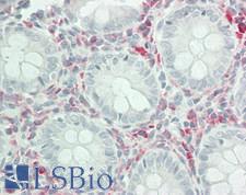 UBFD1 Antibody - Human Colon: Formalin-Fixed, Paraffin-Embedded (FFPE)