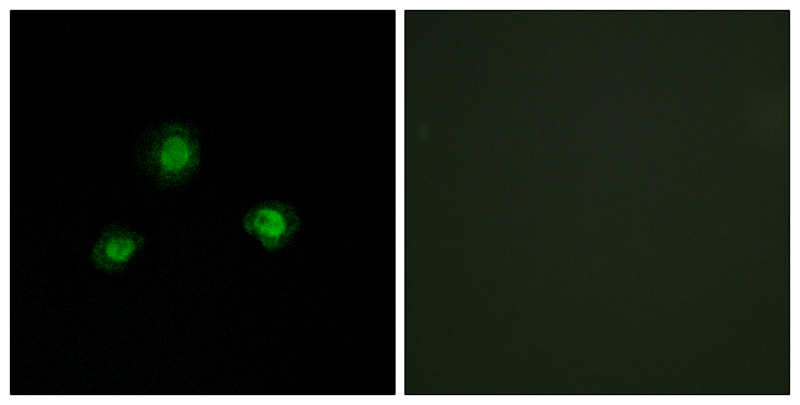 UBN1 / Ubinuclein 1 Antibody - Immunofluorescence analysis of A549 cells, using Ubinuclein Antibody. The picture on the right is blocked with the synthesized peptide.