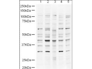 UBP43 / USP18 Antibody - Anti-UBP43 Antibody - Western Blot. Western blot of Affinity Purified anti-UBP43 antibody shows detection of a band ~43 kD band (arrowhead) believed to be to UBP43 in lysates from HeLa nuclear extracts (lane 1) and whole cell lysates from HeLa (lane 2), A431 (lane 3, Jurkat (Lane 4) and HEK293 (lane 5). Approximately 18 ug of each lysate was run on a SDS-PAGE and transferred onto nitrocellulose followed by reaction with a 1:500 dilution of anti-UBP43 antibody. Signal was detected using standard techniques. The strong band between the 37kD and 50kD markers is expected to be UBP43. The other bands are probably non-specific.