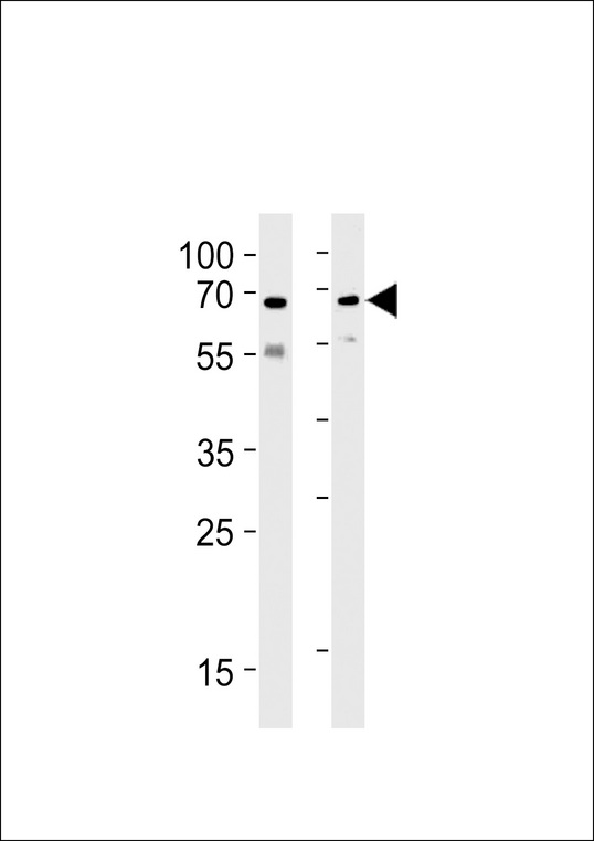UBQLN1 / Ubiquilin Antibody - PLIC1 Antibody (P34) western blot of SH-SY5Y,U87-MG cell line lysates (35 ug/lane). The PLIC1 antibody detected the PLIC1 protein (arrow).