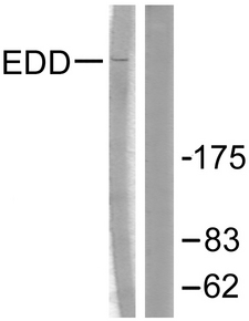 UBR5 Antibody - Western blot analysis of lysates from A549 cells, using EDD Antibody. The lane on the right is blocked with the synthesized peptide.
