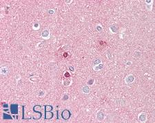 UBR5 Antibody - Anti-UBR5 antibody IHC of human brain, cortex. Immunohistochemistry of formalin-fixed, paraffin-embedded tissue after heat-induced antigen retrieval. Antibody dilution 1:100.
