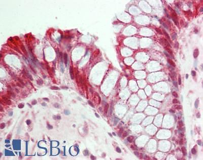 UBR5 Antibody - Human Colon: Formalin-Fixed, Paraffin-Embedded (FFPE)