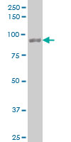 UBTF / UBF Antibody - Western blot of UBTF expression in HepG2.