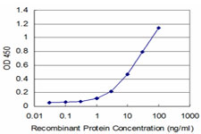 UBTF / UBF Antibody - Detection limit for recombinant GST tagged UBTF is approximately 1 ng/ml as a capture antibody.