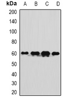 UBXD9 / ASPL Antibody - Western blot analysis of TUG expression in SW480 (A); A549 (B); mouse liver (C); mouse testis (D) whole cell lysates.
