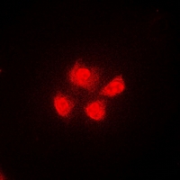 UBXD9 / ASPL Antibody - Immunofluorescent analysis of TUG staining in A549 cells. Formalin-fixed cells were permeabilized with 0.1% Triton X-100 in TBS for 5-10 minutes and blocked with 3% BSA-PBS for 30 minutes at room temperature. Cells were probed with the primary antibody in 3% BSA-PBS and incubated overnight at 4 deg C in a humidified chamber. Cells were washed with PBST and incubated with a DyLight 594-conjugated secondary antibody (red) in PBS at room temperature in the dark.