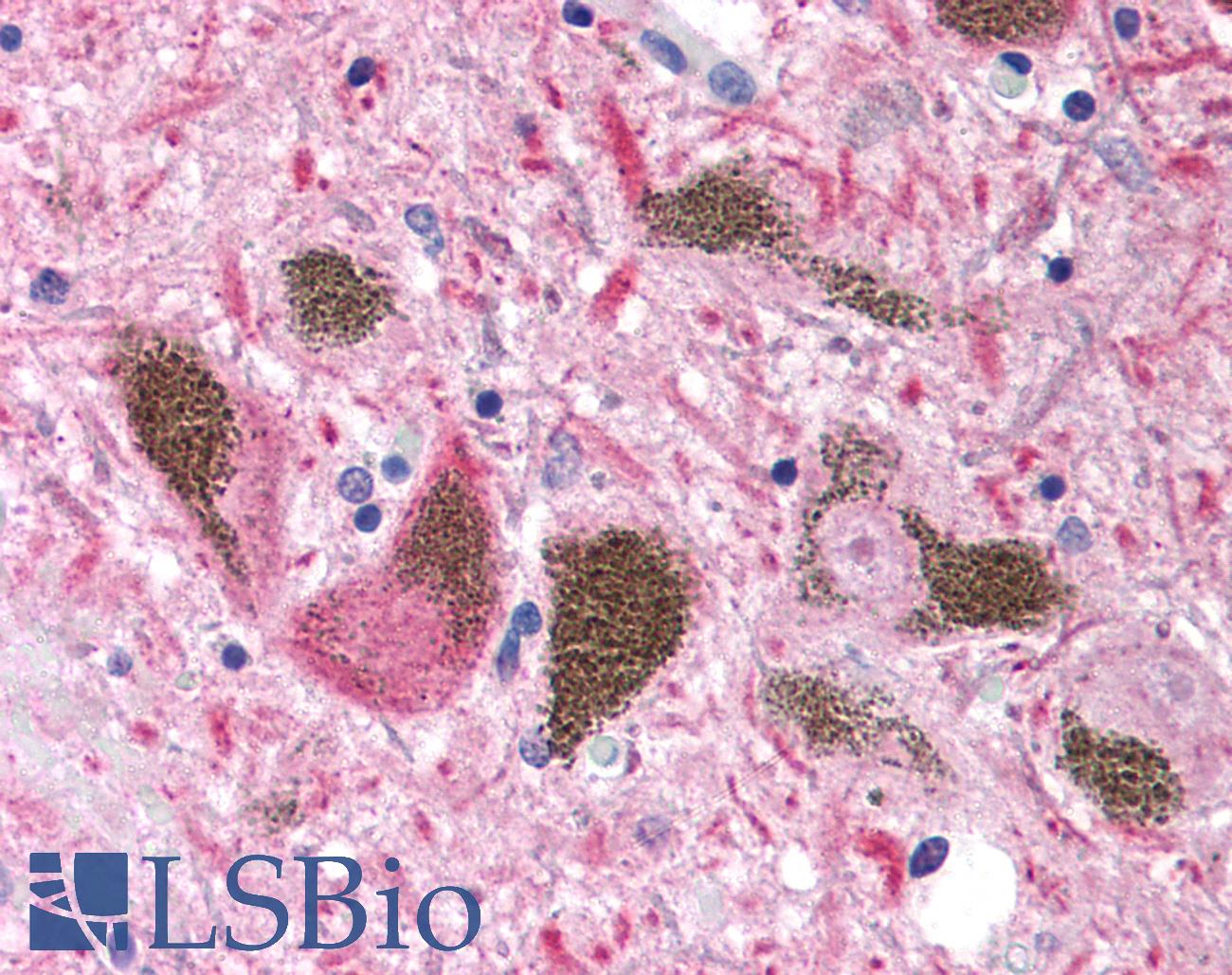 UCHL1 / PGP9.5 Antibody - Anti-UCHL1 / PGP9.5 antibody IHC of human brain, substantia nigra. Immunohistochemistry of formalin-fixed, paraffin-embedded tissue after heat-induced antigen retrieval. Antibody concentration 5 ug/ml.  This image was taken for the unconjugated form of this product. Other forms have not been tested.