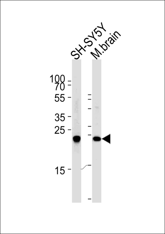 UCHL1 / PGP9.5 Antibody - Western blot of lysates from SH-SY5Y cell line and mouse brain tissue (from left to right),using UCHL1 Antibody. Antibody was diluted at 1:1000 at each lane. A goat anti-rabbit IgG H&L (HRP) at 1:5000 dilution was used as the secondary antibody.Lysates at 35ug per lane.