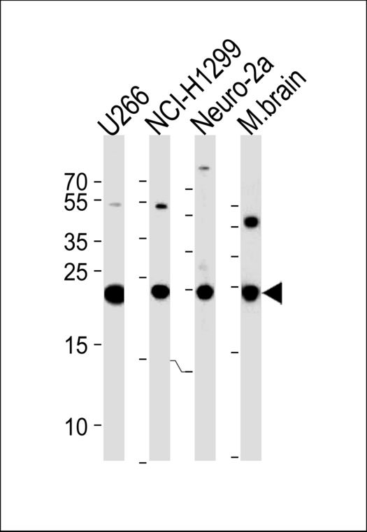 UCHL1 / PGP9.5 Antibody - UCHL1 Antibody western blot of U266,NCI-H1299,mouse Neuro-2a cell line and mouse brain tissue lysates (35 ug/lane). The UCHL1 antibody detected the UCHL1 protein (arrow).