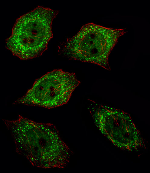 UCHL1 / PGP9.5 Antibody - Fluorescent image of U251 cell stained with UCHL1 Antibody. U251 cells were fixed with 4% PFA (20 min), permeabilized with Triton X-100 (0.1%, 10 min), then incubated with UCHL1 primary antibody (1:25, 1 h at 37°C). For secondary antibody, Alexa Fluor 488 conjugated donkey anti-rabbit antibody (green) was used (1:400, 50 min at 37°C). Cytoplasmic actin was counterstained with Alexa Fluor 555 (red) conjugated Phalloidin (7units/ml, 1 h at 37°C). UCHL1 immunoreactivity is localized to Cytoplasm and Nucleus significantly.