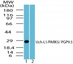 UCHL1 / PGP9.5 Antibody - Western blot of Uch-L1 in human brain lysate in the 1) absence and 2) presence of immunizing peptide using antibody at0.2 ug/ml.