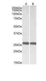 UCHL1 / PGP9.5 Antibody - Goat Anti-UCHL1 (aa 58-68) Antibody (0.01µg/ml) staining of Mouse (A) and Rat (B) Brain lysates (35µg protein in RIPA buffer). Primary incubation was 1 hour. Detected by chemiluminescencence.