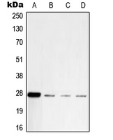UCHL1 / PGP9.5 Antibody - Western blot analysis of PGP9.5 expression in A549 (A); U87 (B); mouse brain (C); rat brain (D) whole cell lysates.