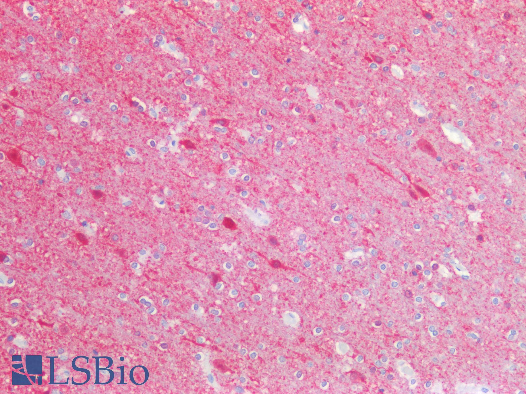UCHL1 / PGP9.5 Antibody - Human Brain, Cortex: Formalin-Fixed, Paraffin-Embedded (FFPE)