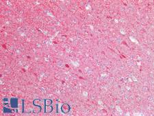 UCHL1 / PGP9.5 Antibody - Human Brain, Cortex: Formalin-Fixed, Paraffin-Embedded (FFPE)