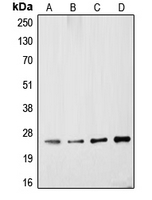 UCHL1 / PGP9.5 Antibody - Western blot analysis of PGP9.5 expression in SKNMC (A); A549 (B); mouse brain (C); rat brain (D) whole cell lysates.