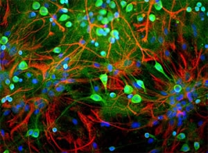 UCHL1 / PGP9.5 Antibody - Shows rat mixed neuron/glial cultures stained with chicken UCHL1 (green) and rabbit antibody to glial fibrillary acidic protein (GFAP-red). Blue is a DNA stain. Note that the UCHL1 stains neurons strongly and specifically, and that the staining is concentrated in the cell bodies, though some does extend into the dendrites also.