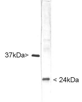 UCHL1 / PGP9.5 Antibody - Blots of whole cell homogenate of the human SH-SY5Y neuroblastoma cell line stained with chicken antibody to glyceraldehyde 3 phosphate dehydrogenase, GAPDH (left lane), and UCHL1 / PGP9.5 Antibody (right lane). The GAPDH antibody stains a ~37kD band while the UCHL1 antibody stains a band at about 24kD.