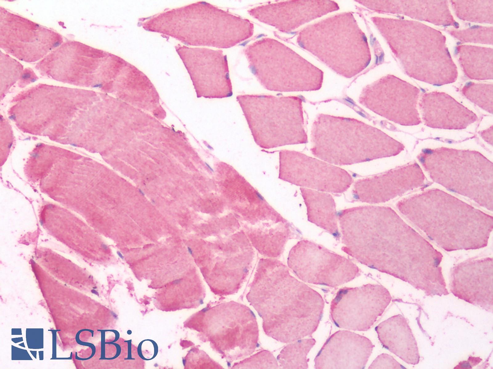 UCHL3 Antibody - Human Skeletal Muscle: Formalin-Fixed, Paraffin-Embedded (FFPE)