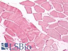UCHL3 Antibody - Human Skeletal Muscle: Formalin-Fixed, Paraffin-Embedded (FFPE)