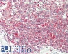 UCHL5 / UCH37 Antibody - Human Spleen: Formalin-Fixed, Paraffin-Embedded (FFPE)