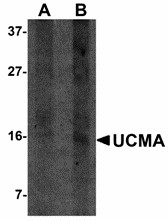 UCMA / GRP Antibody - Western blot of UCMA in SW1353 cell lysate with UCMA antibody at (A) 2.5 and (B) 5 ug/ml.