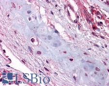 UCMA / GRP Antibody - Anti-UCMA antibody IHC of human lung, chondrocytes. Immunohistochemistry of formalin-fixed, paraffin-embedded tissue after heat-induced antigen retrieval. Antibody concentration 5 ug/ml.